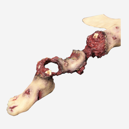 WW3-906 Partial Leg Amputation with Hard Bone (Rignt)