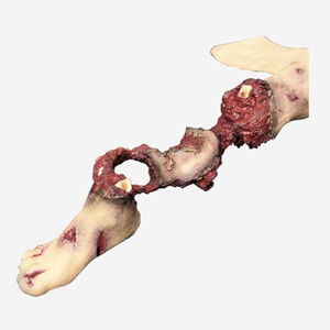 Partial Leg Amputation Hard Bone (Right)